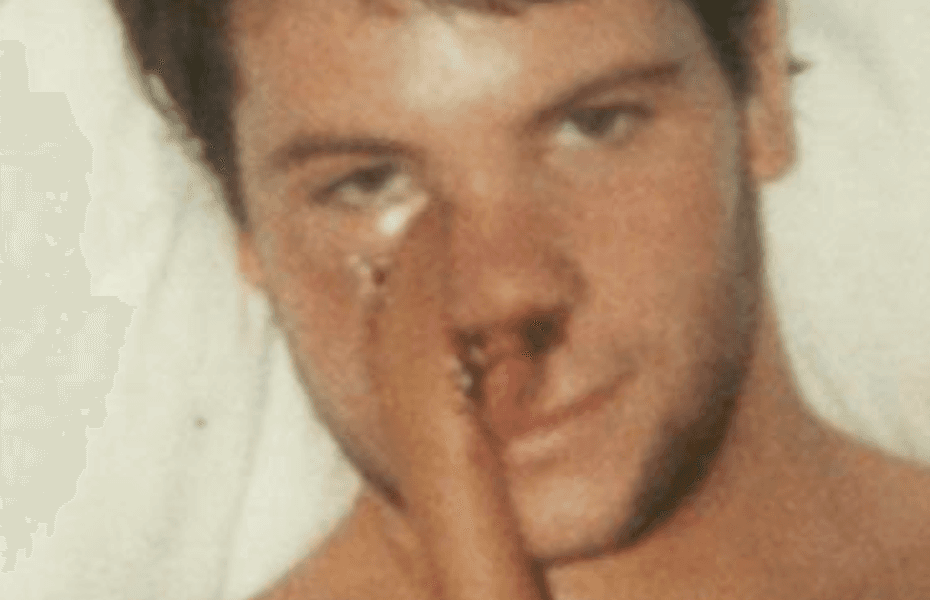 From Disfigurement to Triumph: A Cancer Survivor's Journey